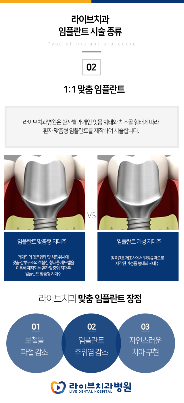 임플란트 종류가 있다는 사실 알고 계셨어요???? 관련 이미지 3