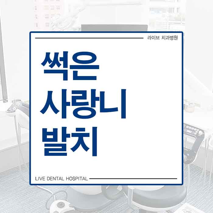 썩은사랑니발치 해야하나요? 관련 이미지 1