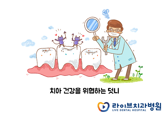 치아의 건강과 미소를 되찾기 위한 덧니교정 관련 이미지 3