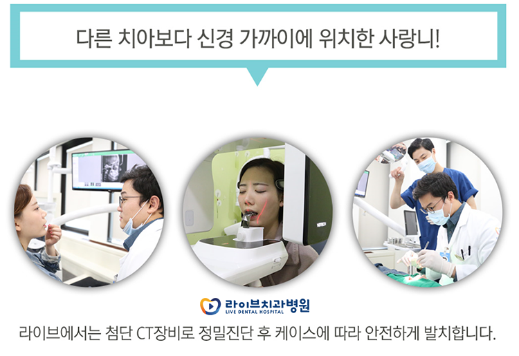 매복사랑니 발치 신중하게 받자 관련 이미지 4