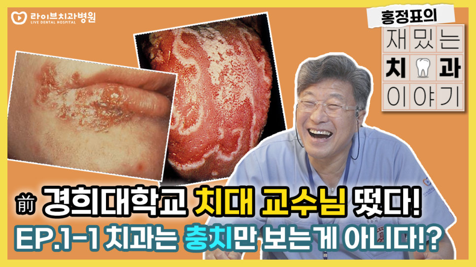 재밌는 치과이야기 EP 1 -1 ㅣ 치과는 충치만 치료하는 곳이 아닙니다. ㅣ 치과, 구강내과, 치아교정, 임플란트, 교수, 썰 관련 이미지 1