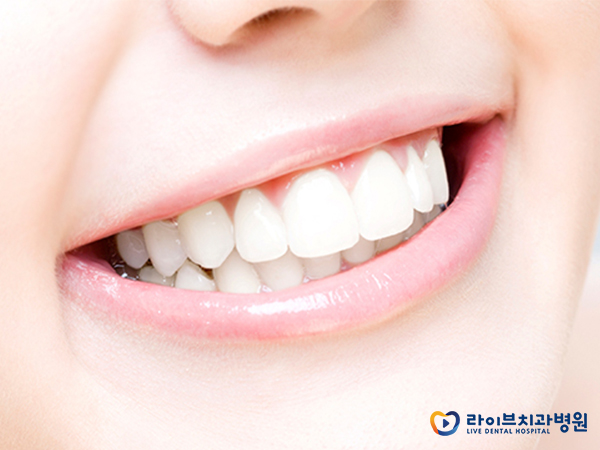 강남치과교정가격, 라이브하게 알아보아요(: 관련 이미지 2