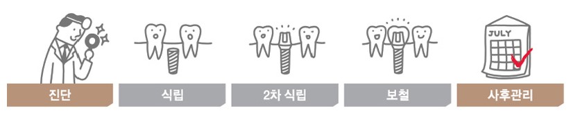 임플란트 가격과 함께 알아볼 체크사항 관련 이미지 6