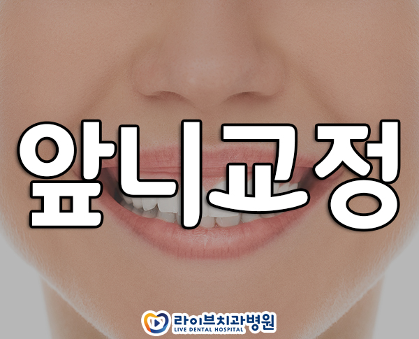 앞니교정 부담없이 받기 위해선? 관련 이미지 1