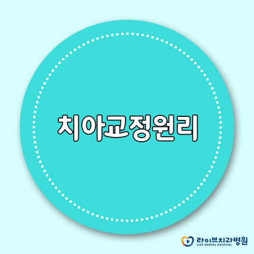 치아교정원리, 교정은 어떻게 진행될까? 관련 이미지 1