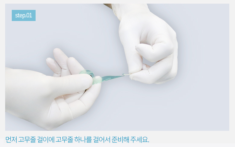 치아교정 고무줄 어렵지 않아요. (feat.영상설명) 관련 이미지 3