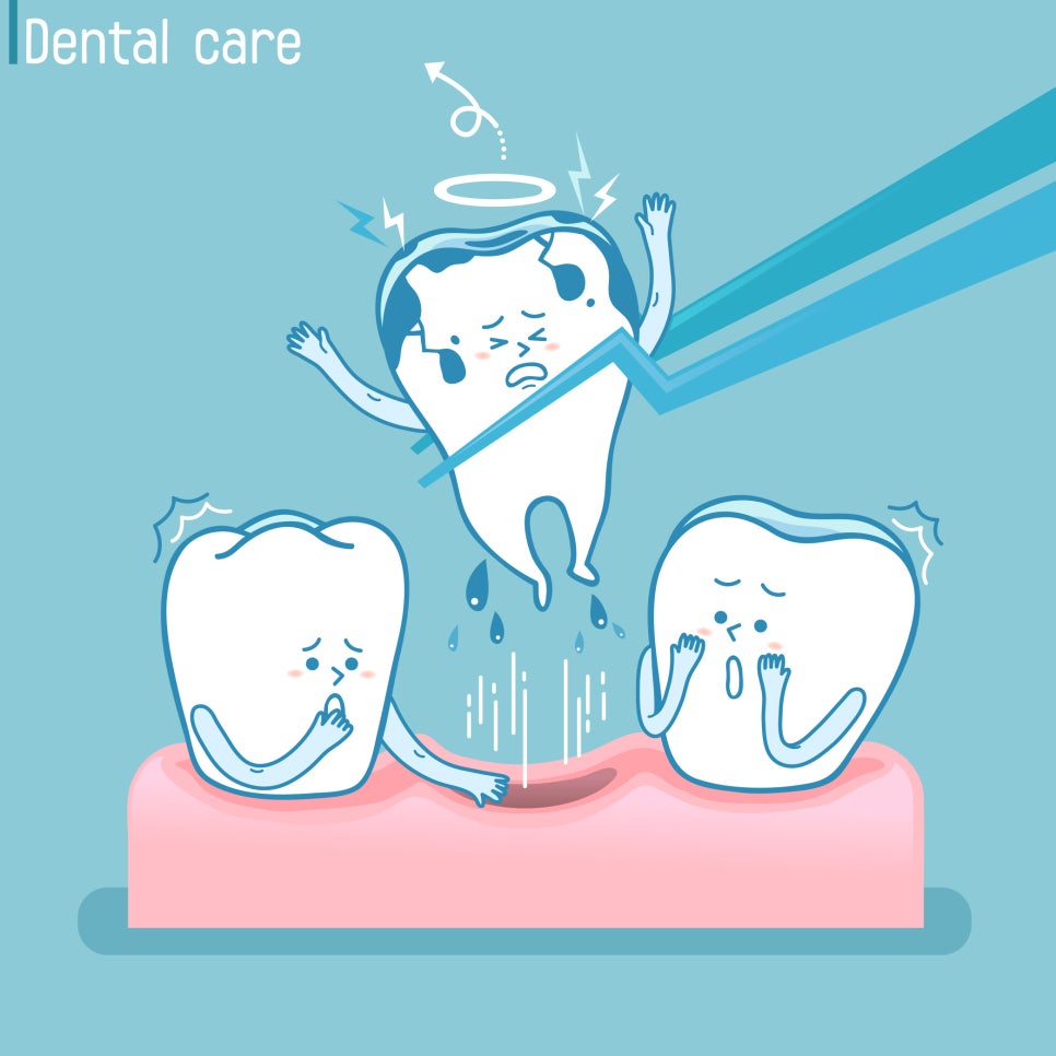 치아 파절 단계별 치료의 중요성 관련 이미지 3