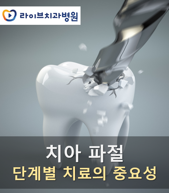 치아 파절 단계별 치료의 중요성 관련 이미지 1