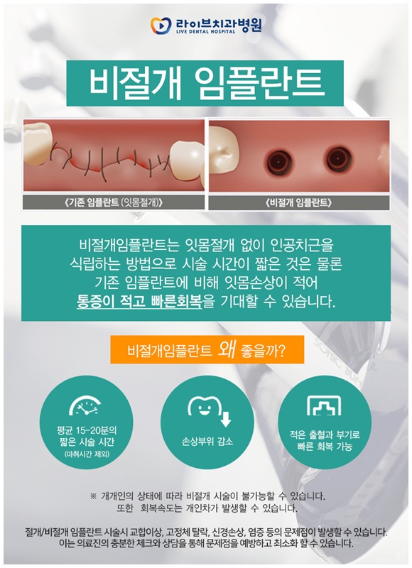 전체임플란트 꼼꼼하게 알아보고 분납까지! 관련 이미지 4
