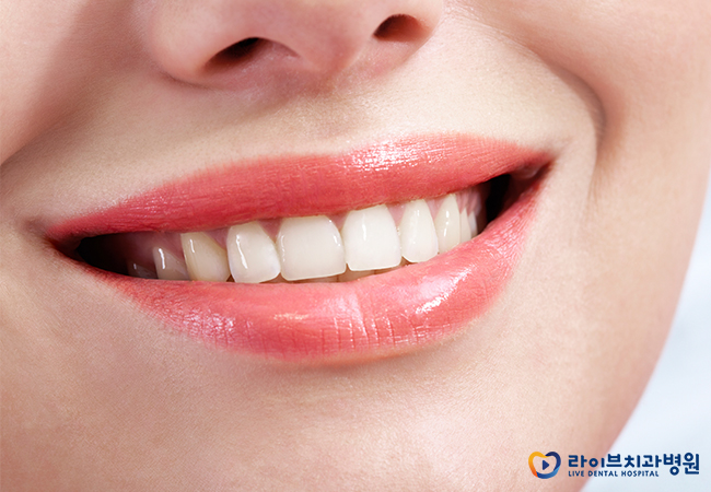 앞니부분교정, 내게도 적합한 치료일까? 관련 이미지 6