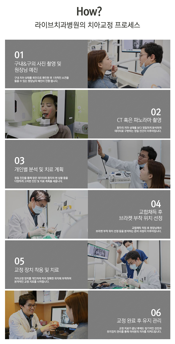 서초동 세라믹교정 알아볼까요? 관련 이미지 4