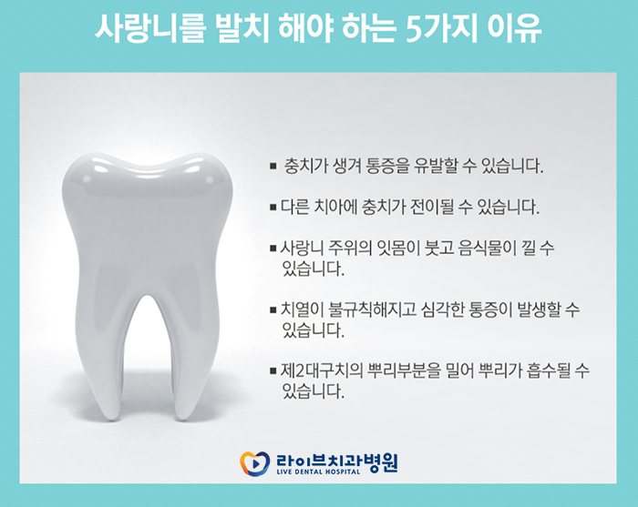 사랑니 발치 후 식사 어떻게 하지 관련 이미지 3