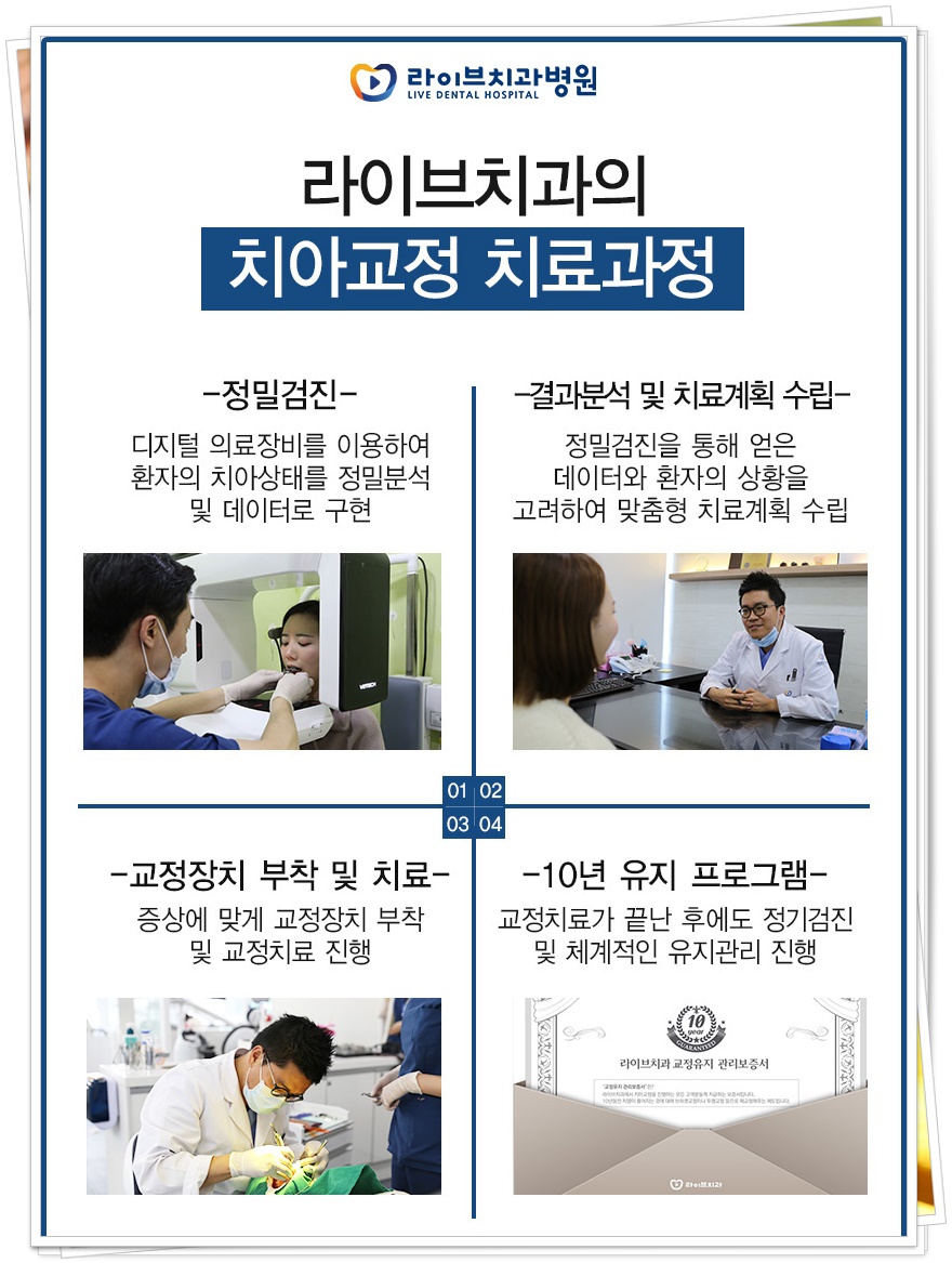 치아교정기 종류 원하는 목적에 맞게 관련 이미지 3