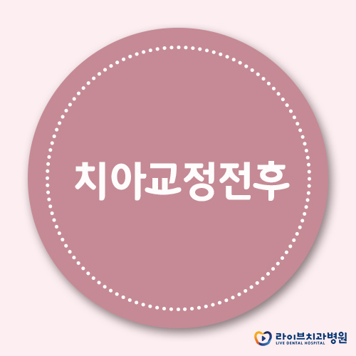 치아교정전후, 달라질 모습을 기대해도 될까요? 관련 이미지 1