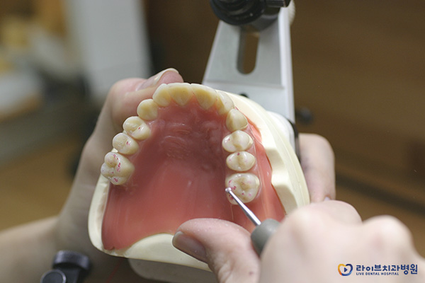 임플란트뼈이식 필요한 이유를 알아보자! 관련 이미지 5