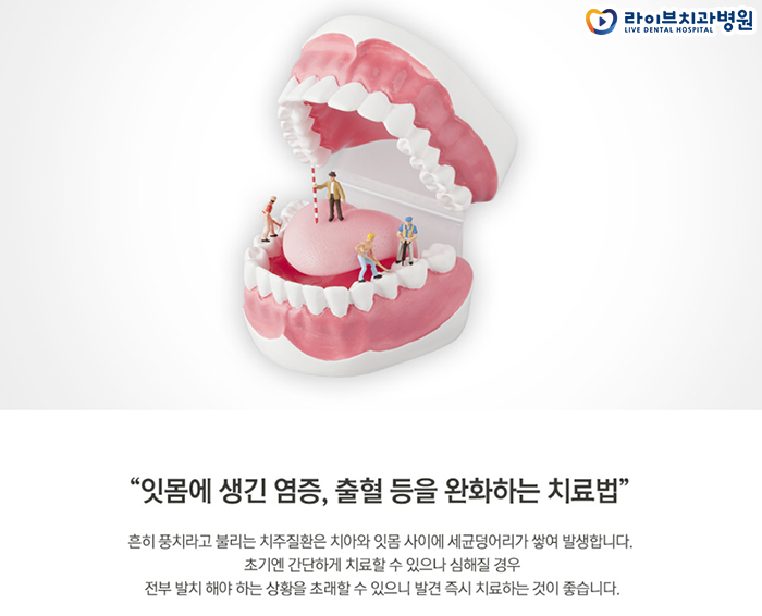 잇몸치료 방법 치료과정에 대해서 관련 이미지 2