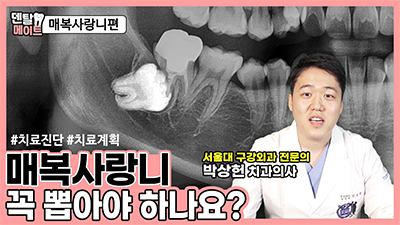 매복사랑니 꼭 뽑아야 하나요? | 덴탈메이트 관련 이미지 1
