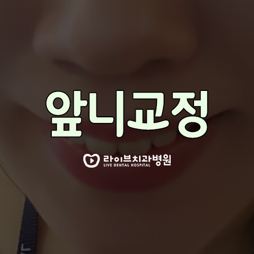 앞니교정, 부분적으로 빠르게 개선하세요! 관련 이미지 1