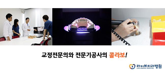 투명교정, 예비신부도 취준생도 오케이! 관련 이미지 6