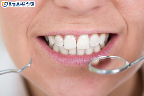 클리피씨교정 가격부터 장단점까지 관련 이미지 3