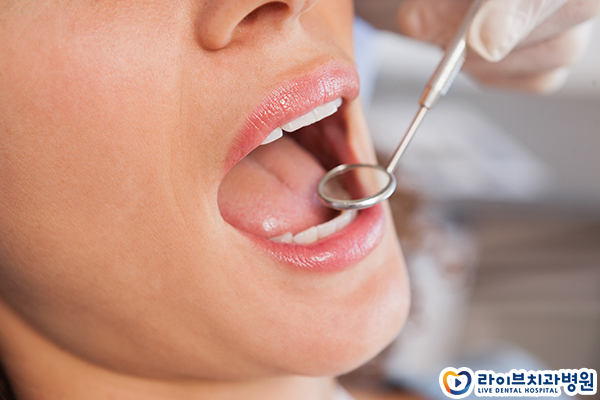 돌출입교정 개선할 수 있을까요 관련 이미지 4