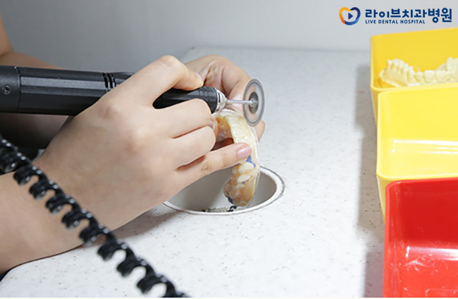 투명교정, 브라켓교정이 부담된다면? 관련 이미지 5