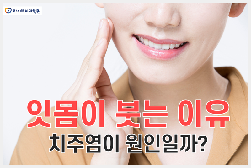 잇몸이 붓는 이유 치주염이 원인일까? 관련 이미지 1