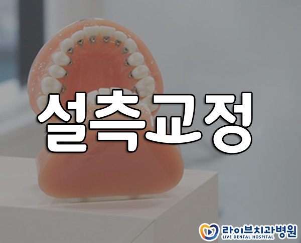 설측교정 티나지 않게 교정하려면 관련 이미지 1
