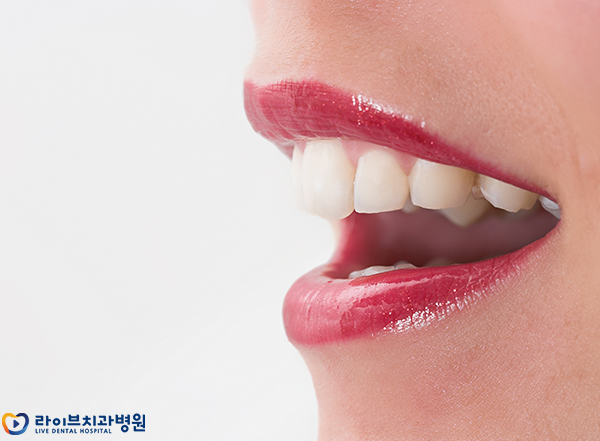 돌출입교정 개선할 수 있을까요 관련 이미지 2