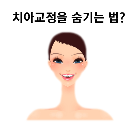 설측교정, 보이지 않는다 아무것도! 관련 이미지 2