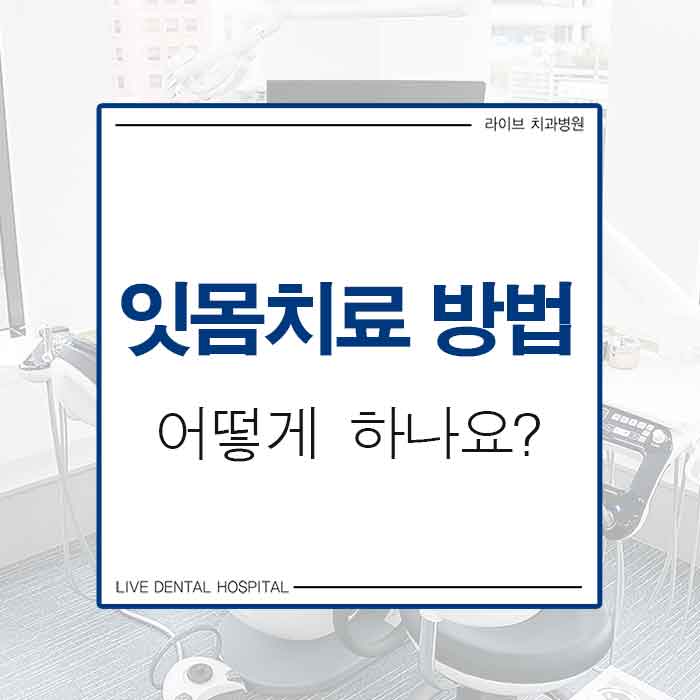 잇몸치료 방법 치료과정에 대해서 관련 이미지 1