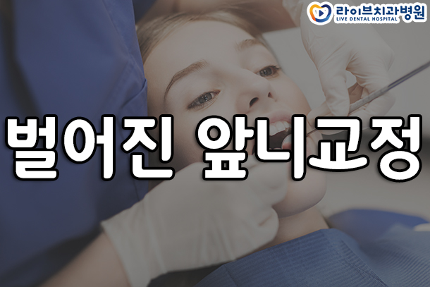 벌어진 앞니교정 가지런하게 가능할까? 관련 이미지 1