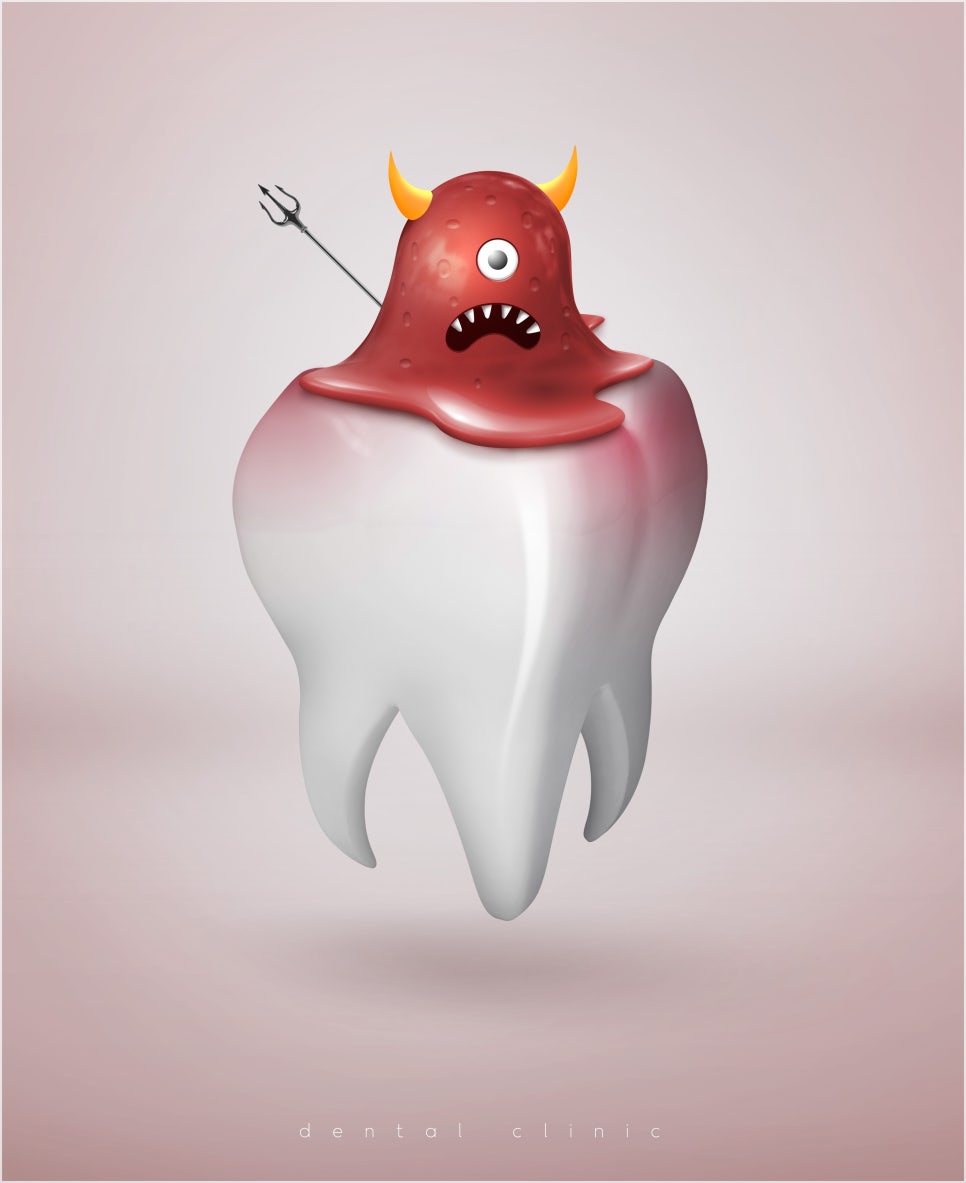 충치치료 아픈가요 통증 정도는? 관련 이미지 2