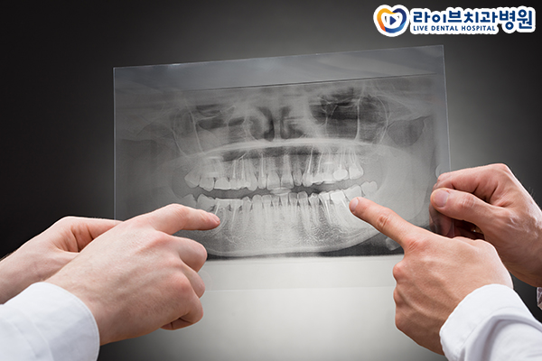 인천치아교정 치과비용 얼마나 필요할까 관련 이미지 2