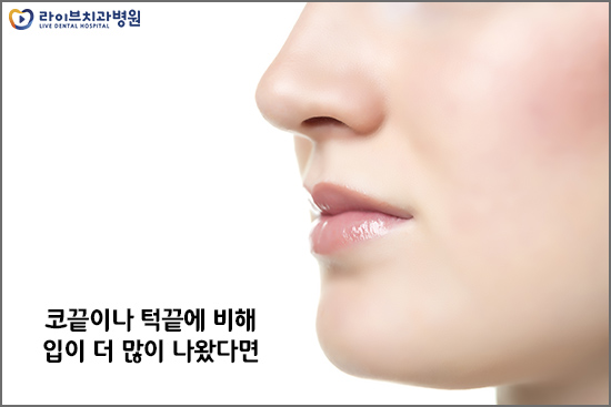 입툭튀교정 돌출입을 개선해보자 관련 이미지 2