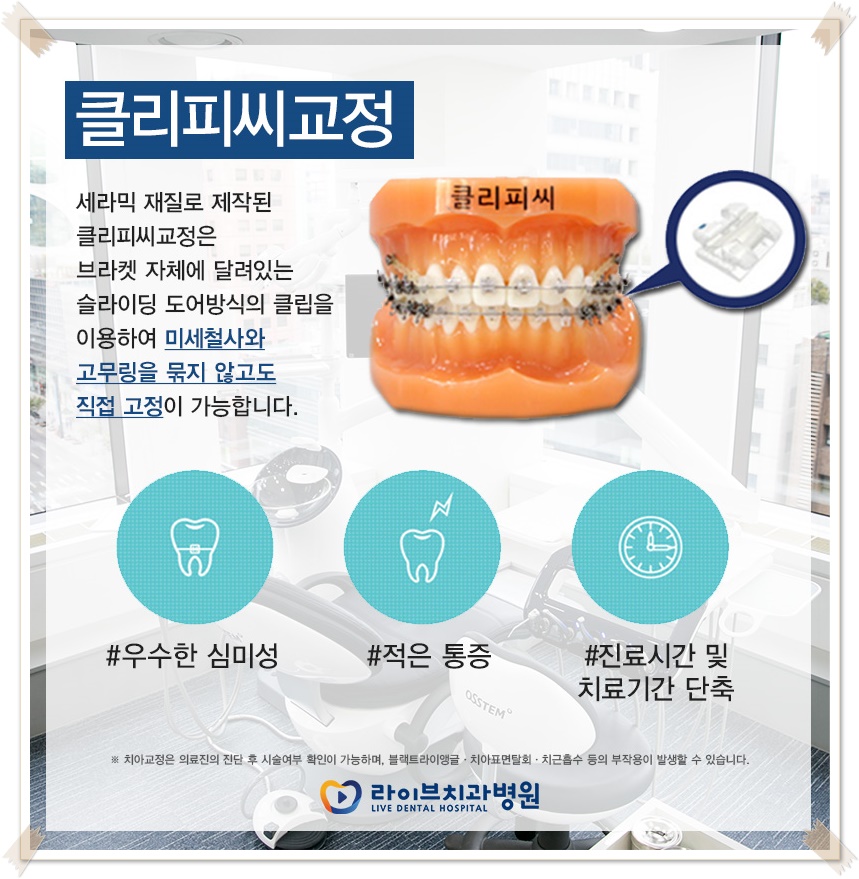 치아교정종류 상황에 맞게! 관련 이미지 10