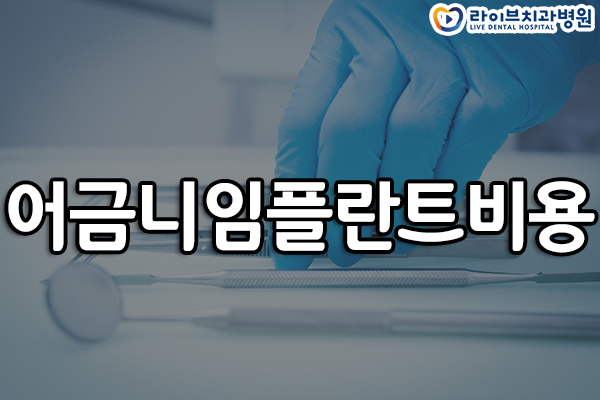 어금니임플란트비용 고민되네요 관련 이미지 1