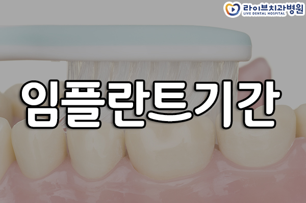 임플란트기간 얼마나 잡아야 할까요? 관련 이미지 1