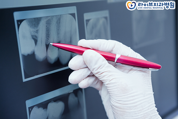 치아교정가격은 어느정도 되나요 관련 이미지 3