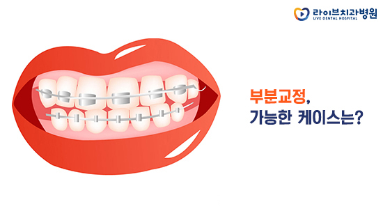부분교정, 빠르고 효율적으로! 관련 이미지 2