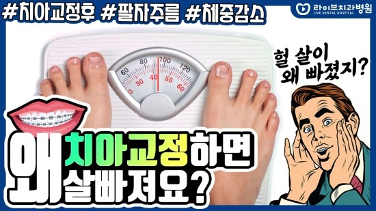 치아교정하면 살이 빠지나요? [응답하라치과의사 치아교정편] 관련 이미지 1