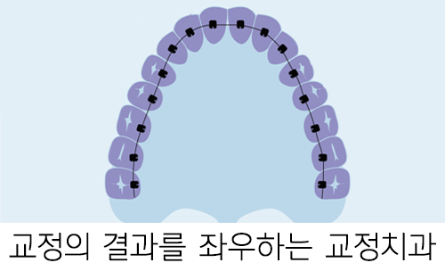 교정치과 선택, 어떤 결과를 가져올까? 관련 이미지 3