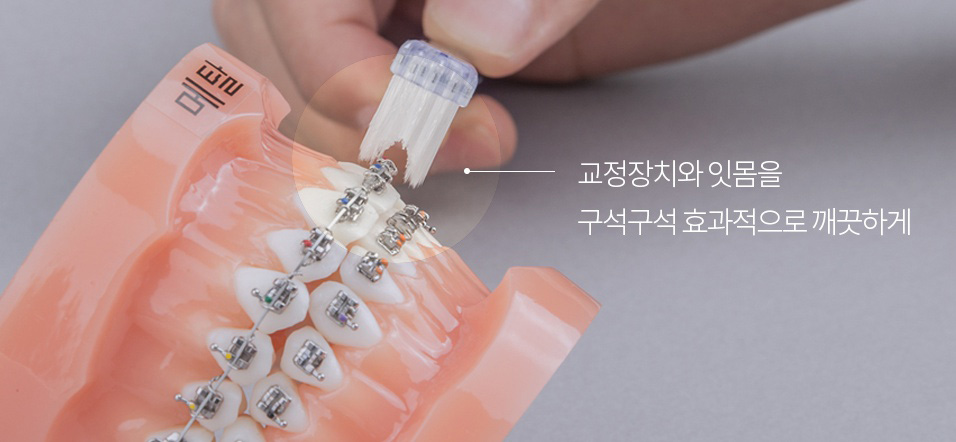 치아교정관리, 양치법부터 바로 알자! 관련 이미지 3