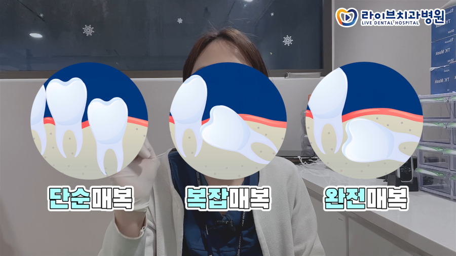 라이브치과 VLOG｜매복 사랑니 발치 과정과 필요한 발치기구, 보철과 일상vlog, 직장인 브이로그 관련 이미지 3