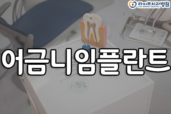 어금니임플란트 언제 해야 될까? 관련 이미지 1