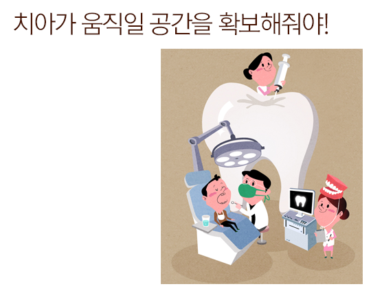 발치교정, 모두에게 필요할까? 관련 이미지 4