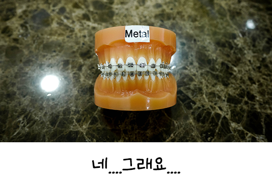 세라믹교정으로 깔끔하게 교정해요! 관련 이미지 4