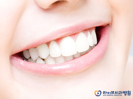 강남치아교정, 특명 미소의 자신감을 찾아라! 관련 이미지 2