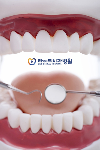 올바른 교정치료 라이브 치아교정FAQ 1편 관련 이미지 3