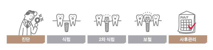 임플란트기간에 대한 모든 궁금증 타파! 관련 이미지 3